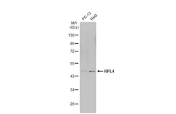 Anti-RPL4 antibody used in Western Blot (WB). GTX112184