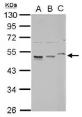 Anti-RPL4 antibody used in Western Blot (WB). GTX112184
