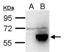 Anti-TIP60 antibody used in Western Blot (WB). GTX112197