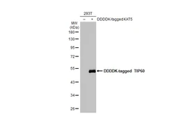 Anti-TIP60 antibody used in Western Blot (WB). GTX112197