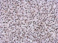 Anti-TIP60 antibody used in IHC (Paraffin sections) (IHC-P). GTX112198