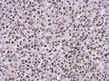 Anti-TIP60 antibody used in IHC (Paraffin sections) (IHC-P). GTX112198