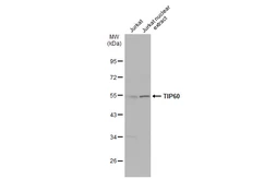 Anti-TIP60 antibody used in Western Blot (WB). GTX112198