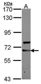 Anti-AHCYL1 antibody used in Western Blot (WB). GTX112201