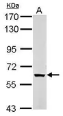 Anti-KPNA5 antibody used in Western Blot (WB). GTX112203