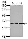 Anti-ThPok antibody [N2C2], Internal used in Western Blot (WB). GTX112204