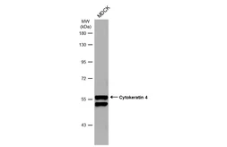 Anti-Cytokeratin 4 antibody used in Western Blot (WB). GTX112211
