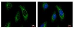 Anti-Cytokeratin 4 antibody used in Immunocytochemistry/ Immunofluorescence (ICC/IF). GTX112211