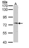 Anti-GGA2 antibody used in Western Blot (WB). GTX112213