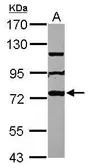 Anti-MPHOSPH10 antibody used in Western Blot (WB). GTX112221