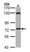 Anti-EXOC7 antibody [C2C3], C-term used in Western Blot (WB). GTX112222