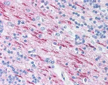 Anti-Myelin basic protein antibody [22] used in IHC (Paraffin sections) (IHC-P). GTX11223