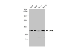 Anti-ZHX2 antibody [C1C3] used in Western Blot (WB). GTX112232