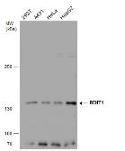 Anti-RENT1 antibody [C1C2], Internal used in Western Blot (WB). GTX112241