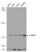 Anti-RENT1 antibody [C1C2], Internal used in Western Blot (WB). GTX112241