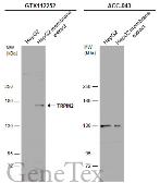 Anti-TRPM2 antibody [N1N2-2], N-term used in Western Blot (WB). GTX112252