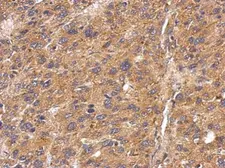 Anti-Fetuin B antibody used in IHC (Paraffin sections) (IHC-P). GTX112260