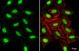 Anti-SUV39H1 antibody [N3C3] used in Immunocytochemistry/ Immunofluorescence (ICC/IF). GTX112263