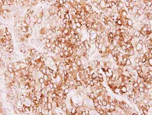 Anti-Creatine kinase MT antibody [N1C2] used in IHC (Paraffin sections) (IHC-P). GTX112264