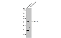 Anti-SESN3 antibody used in Western Blot (WB). GTX112277