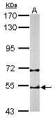 Anti-TCP1 beta antibody [C1C3] used in Western Blot (WB). GTX112283