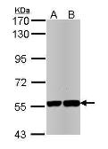 Anti-SRP1 antibody used in Western Blot (WB). GTX112284