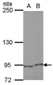 Anti-E2F8 antibody [N3C3] used in Western Blot (WB). GTX112299