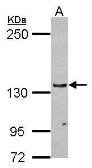 Anti-RENT1 antibody [N1N2], N-term used in Western Blot (WB). GTX112303