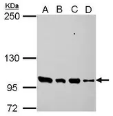 Anti-PDE3A antibody [N3C1], Internal used in Western Blot (WB). GTX112305