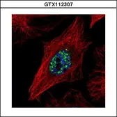 Anti-NCOA2 antibody [C2C3], C-term used in Immunocytochemistry/ Immunofluorescence (ICC/IF). GTX112307