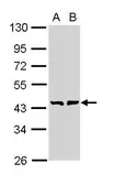 Anti-GMDS antibody [N2C3] used in Western Blot (WB). GTX112327