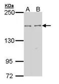Anti-EPB41L2 antibody [N1N3] used in Western Blot (WB). GTX112337