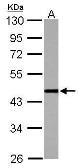 Anti-cleavage stimulation factor antibody [N3C3] used in Western Blot (WB). GTX112345
