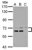 Anti-DYNC1I1 antibody [N3C2], Internal used in Western Blot (WB). GTX112355