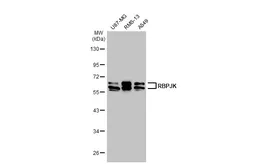 Anti-RBPJK antibody [C1C3] used in Western Blot (WB). GTX112358
