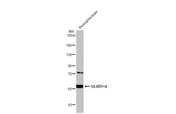 Anti-GLUD1 + GLUD2 antibody used in Western Blot (WB). GTX112361