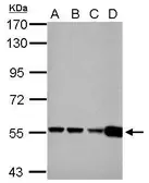 Anti-GLUD1 + GLUD2 antibody used in Western Blot (WB). GTX112361