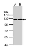 Anti-ATP citrate lyase antibody [C2C3], C-term used in Western Blot (WB). GTX112379