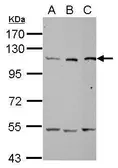 Anti-alanyl-tRNA synthetase antibody [N1N2], N-term used in Western Blot (WB). GTX112386