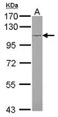 Anti-beta Adducin antibody [N3C2], Internal used in Western Blot (WB). GTX112389