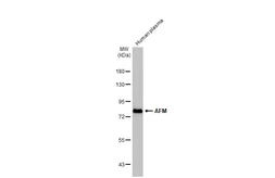 Anti-AFM antibody used in Western Blot (WB). GTX112390