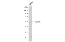 Anti-ALDH3A1 antibody [N1C2] used in Western Blot (WB). GTX112391