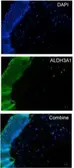 Anti-ALDH3A1 antibody [N1C2] used in IHC (Frozen sections) (IHC-Fr). GTX112391
