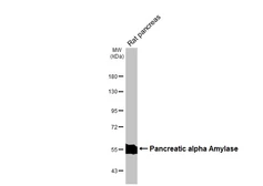 Anti-Pancreatic alpha Amylase antibody [N3C3] used in Western Blot (WB). GTX112396