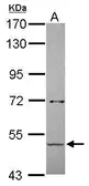 Anti-alpha amylase 2B (pancreatic) antibody [N3C3] used in Western Blot (WB). GTX112396