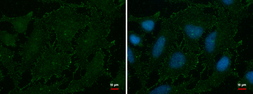 Anti-AOC2 antibody used in Immunocytochemistry/ Immunofluorescence (ICC/IF). GTX112397