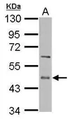 Anti-ENTPD5 antibody [N3C3] used in Western Blot (WB). GTX112405
