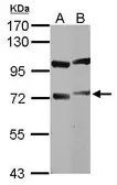 Anti-DYNC1I1 antibody used in Western Blot (WB). GTX112418