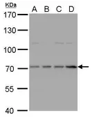 Anti-HDC antibody [N3C2], Internal used in Western Blot (WB). GTX112435