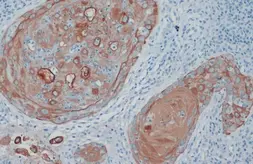 Anti-Cytokeratin 33B antibody used in IHC (Paraffin sections) (IHC-P). GTX112454
